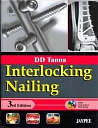 Interlocking Nailing (Hardcover, DVD-ROM, 3rd)