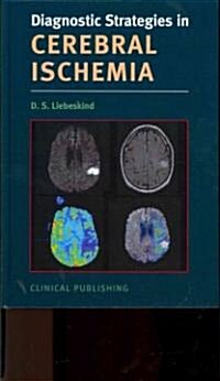 Cerebral Ischemia (Hardcover)