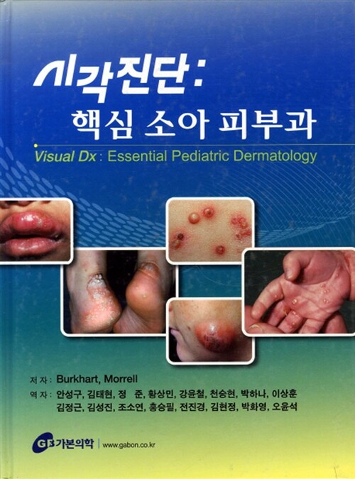 시각진단 : 핵심 소아 피부과
