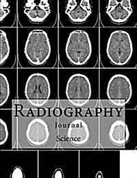 Radiography Journal: Science Journal with 150 Lined Pages (Paperback)