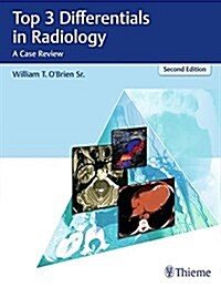 Top 3 Differentials in Radiology: A Case Review (Paperback, 2)