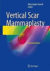 Vertical Scar Mammaplasty (Hardcover, 2, 2018)