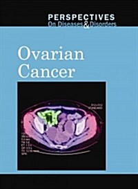 Ovarian Cancer (Library Binding)