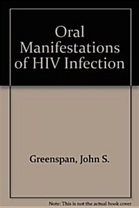 Oral Manifestations of HIV Infection (Paperback)