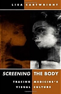 Screening the Body: Tracing Medicines Visual Culture (Paperback)