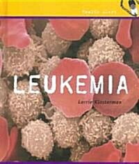 Leukemia (Library Binding)