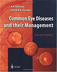 Common Eye Diseases and Their Management (Paperback, 2nd)