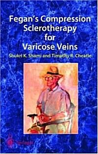 Fegans Compression Sclerotherapy for Varicose Veins (Hardcover, 2)