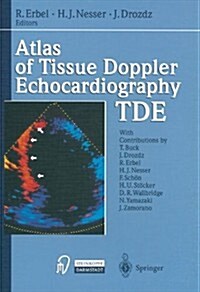 Atlas of Tissue Doppler Echocardiography Tde (Hardcover)