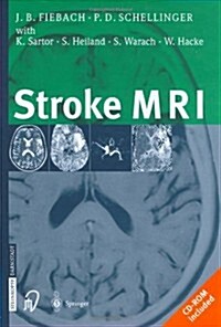 Stroke MRI [With CDROM] (Hardcover)