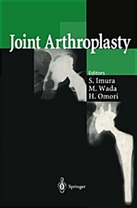 Joint Arthroplasty (Hardcover)