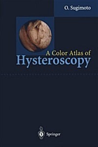 A Color Atlas of Hysteroscopy (Hardcover)