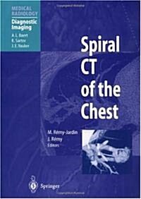 Spiral CT of the Chest (Paperback, 1997. 2nd Print)