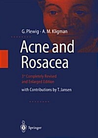 Acne and Rosacea (Hardcover, 3, Completely REV.)