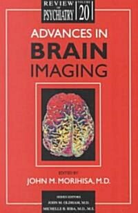 Advances in Brain Imaging (Paperback)