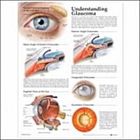 UNDERSTANDING GLAUCOMA ANATOMICAL CHART (Paperback)