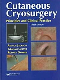 Cutaneous Cryosurgery (Hardcover, 3rd)
