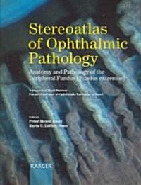 Stereoatlas of Ophthalmic Pathology (Hardcover, 1st, Spiral)
