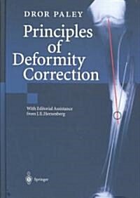 Principles of Deformity Correction (Hardcover)