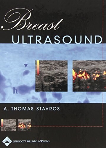 Breast Ultrasound (Hardcover)