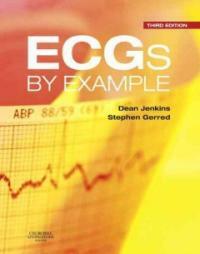 ECGs by example 3rd ed