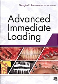 Advanced Immediate Loading (Hardcover)