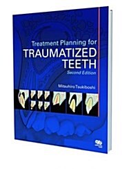 Treatment Planning for Traumatized Teeth (Paperback, 2nd)