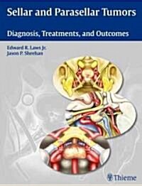 Sellar and Parasellar Tumors: Diagnosis, Treatments, and Outcomes (Hardcover)