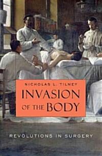[중고] Invasion of the Body: Revolutions in Surgery (Hardcover)