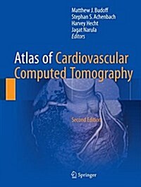 Atlas of Cardiovascular Computed Tomography (Hardcover, 2nd ed. 2018)