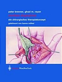 Morbus Dupuytren: Ein Chirurgisches Therapiekonzept (Hardcover)