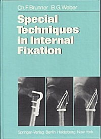 Special Techniques in Internal Fixation (Hardcover)