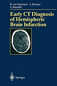 Early Ct Diagnosis of Hemispheric Brain Infarction (Paperback)