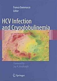 HCV Infection and Cryoglobulinemia (Hardcover)