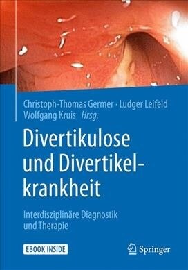 Divertikulose Und Divertikelkrankheit: Interdisziplin?e Diagnostik Und Therapie (Hardcover, 1. Aufl. 2018)