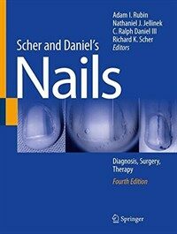 Scher and Daniel's nails : diagnosis, surgery, therapy