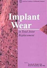 Implant Wear in Total Joint Replacement (Paperback)