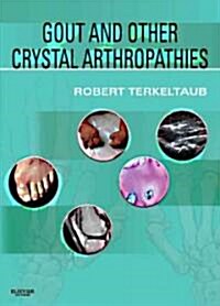 Gout & Other Crystal Arthropathies : Expert Consult: Online and Print (Hardcover)