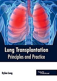 Lung Transplantation: Principles and Practice (Hardcover)