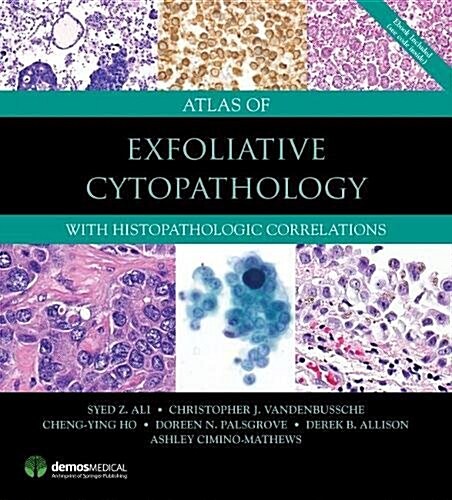 Atlas of Exfoliative Cytopathology: With Histopathologic Correlations (Hardcover)