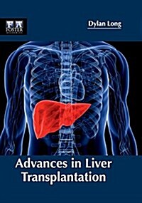 Advances in Liver Transplantation (Hardcover)