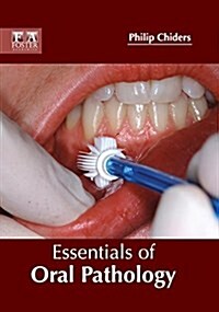 Essentials of Oral Pathology (Hardcover)