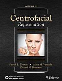 Centrofacial Rejuvenation (Hardcover)