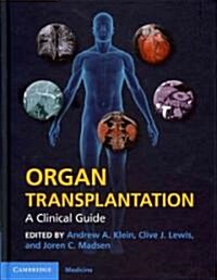 Organ Transplantation : A Clinical Guide (Hardcover)
