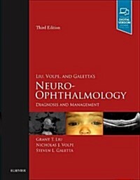 Liu, Volpe, and Galettas Neuro-Ophthalmology: Diagnosis and Management (Hardcover, 3)