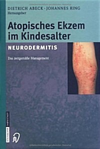 Atopisches Ekzem Im Kindesalter (Neurodermitis): Zeitgemaaes Management (Hardcover)
