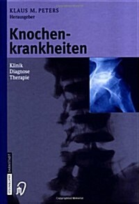 Knochenkrankheiten: Klinik Diagnose Therapie (Hardcover, 2002)