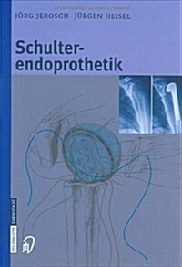 Schulterendoprothetik: Indikation, Implantate, Op-Technik, Nachbehandlung, Begutachtung (Hardcover, 2002)