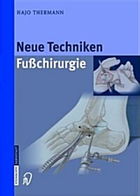 Neue Techniken Fusschirurgie (Hardcover)
