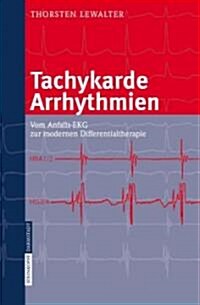 Tachykarde Arrhythmien: Vom Anfalls-EKG Zur Modernen Differentialtherapie (Hardcover)